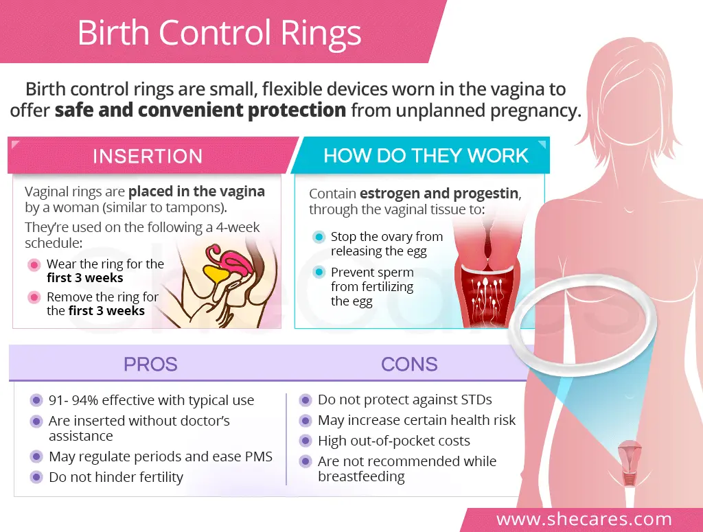 Vaginal ring &#8211; application, advantages and disadvantages