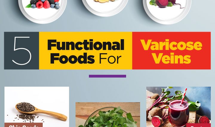 Varicose veins diet &#8211; what to eat to strengthen the veins?