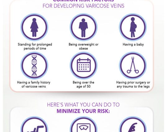 Varicose veins &#8211; what are they? How to prevent varicose veins and how to treat them?