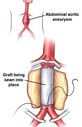 Vascular surgery &#8211; scope, methods of diagnosis and treatment