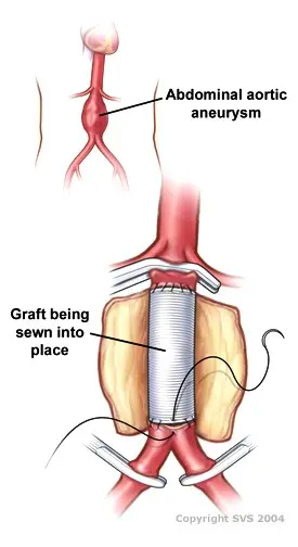 Vascular surgery &#8211; scope, methods of diagnosis and treatment