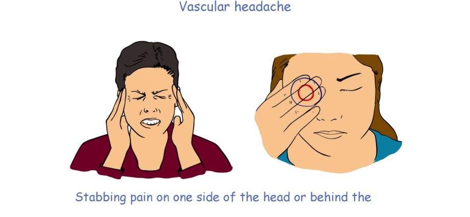 Vasomotor headaches