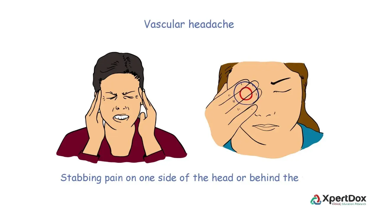 Vasomotor headaches