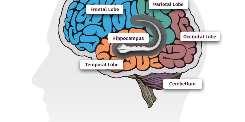 Visual disturbances can be a harbinger of dementia