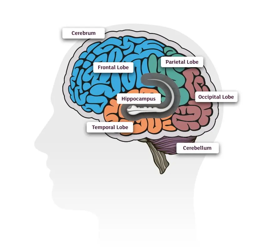 Visual disturbances can be a harbinger of dementia