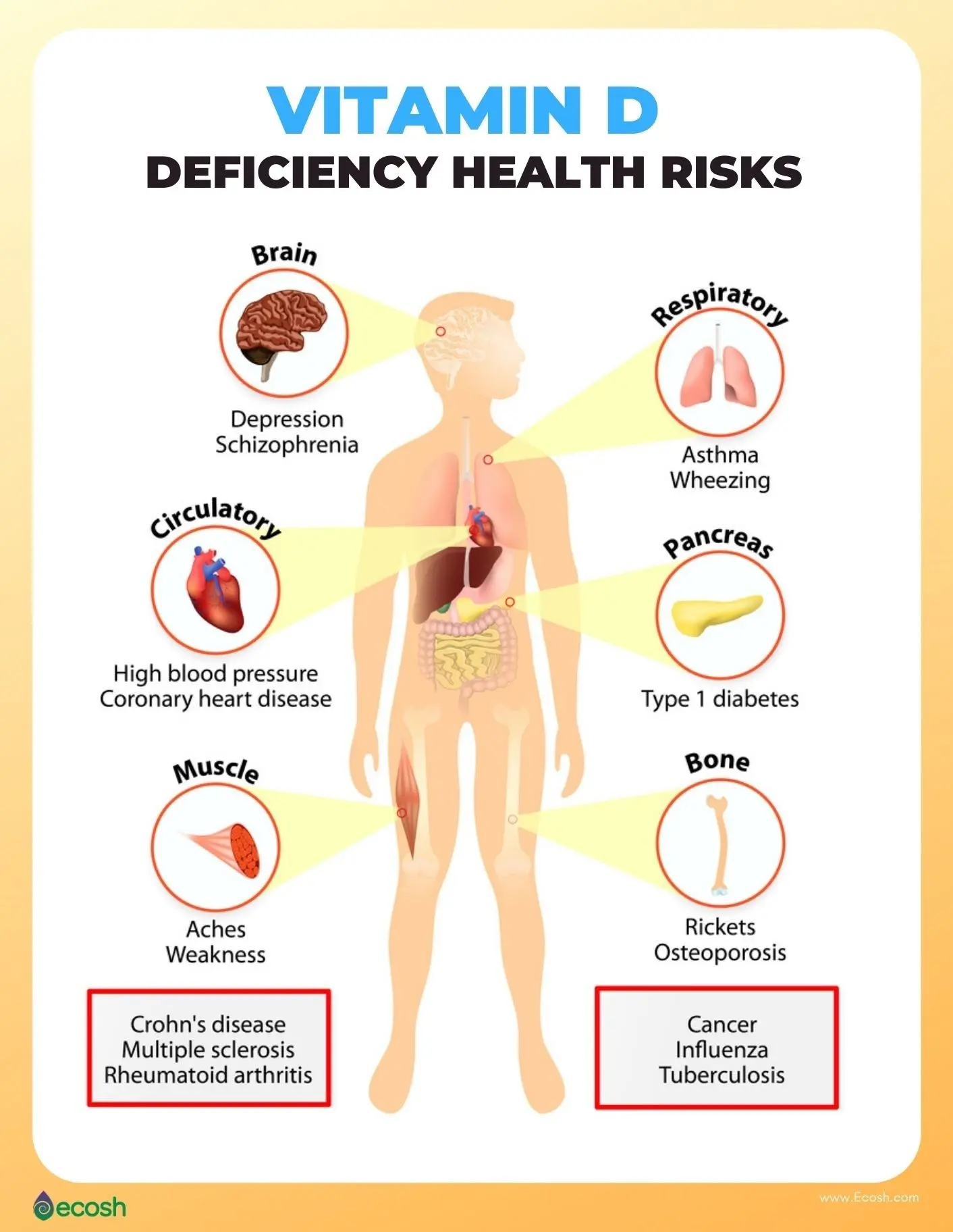 Vitamin D deficiency &#8211; causes, effects, risk groups