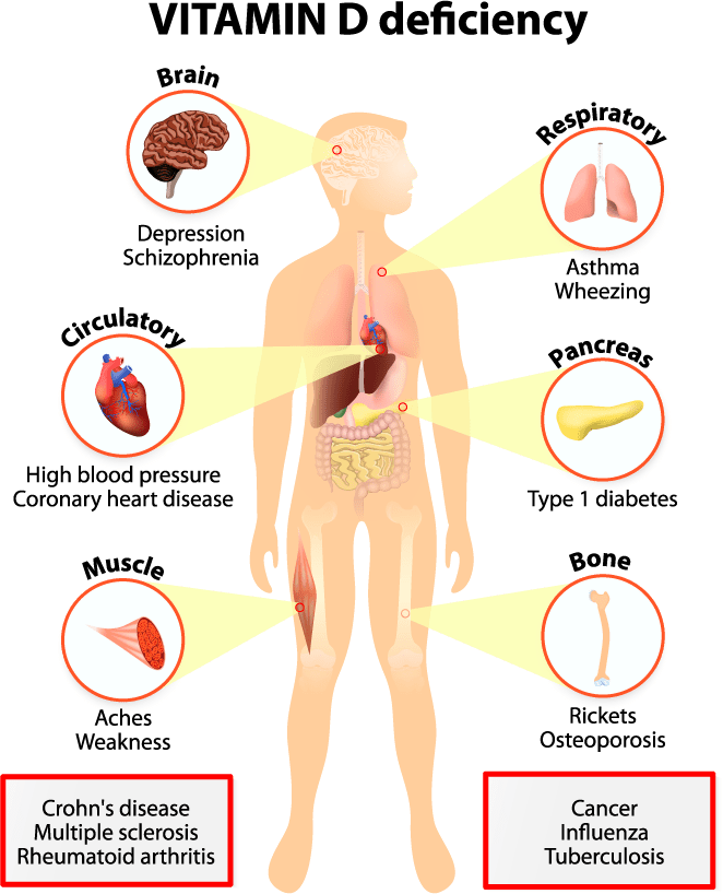 vitamin-d-deficiency-slowly-exhausts-the-body-here-are-the-most-common