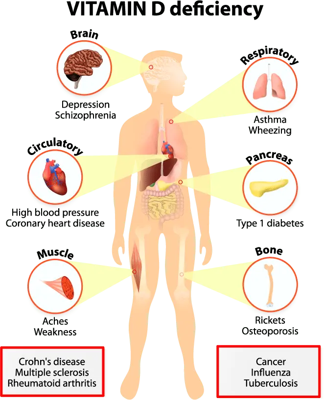 Vitamin D deficiency slowly exhausts the body. Here are the most common symptoms