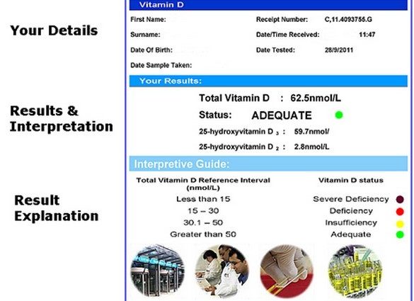 Vitamin D3 level test &#8211; when to do it and how much does it cost?