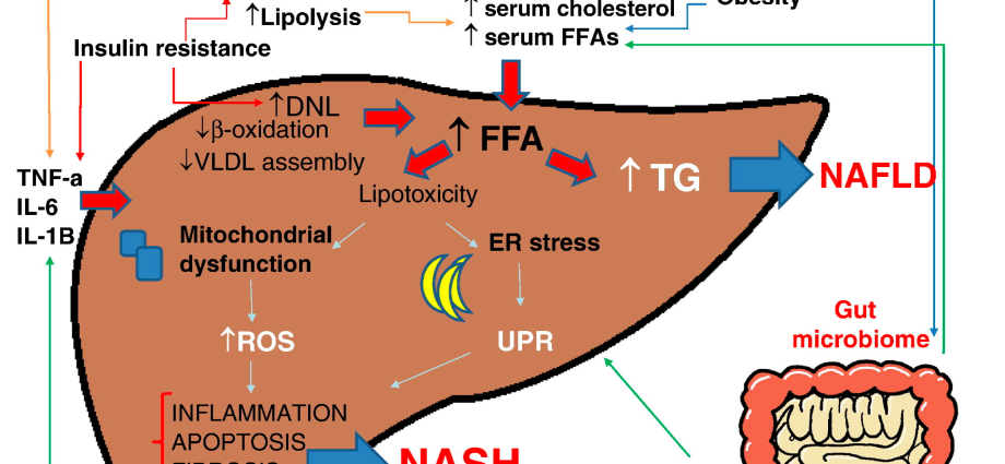 Vitamin E for fatty liver