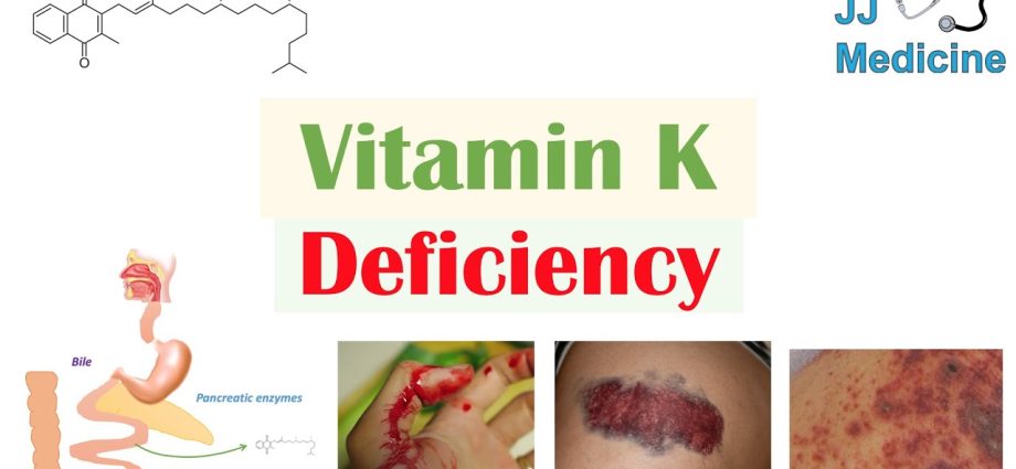 Vitamin K for vitamin K deficiency. Indications for use