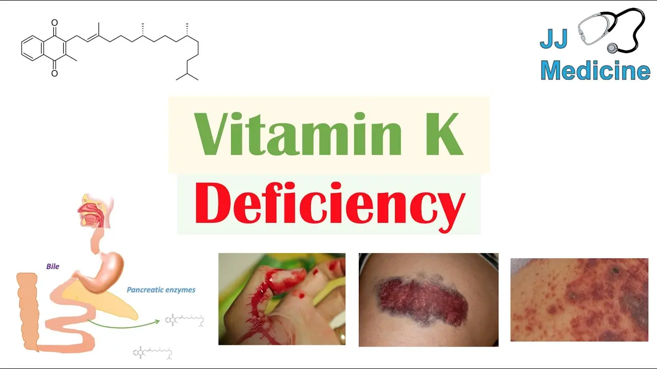 Vitamin K for vitamin K deficiency. Indications for use