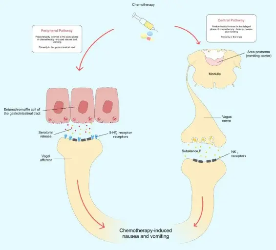 Vomiting with chemotherapy