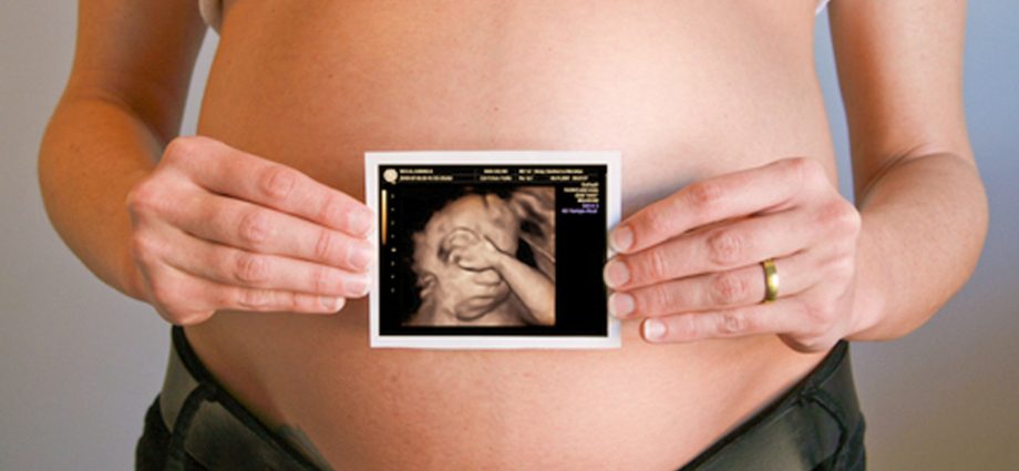 Warsaw: May 17 and 18, free 4D ultrasound and consultations for pregnant women