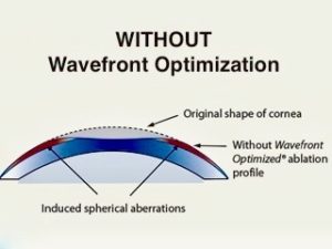 Wavefront &#8211; personalized vision correction treatment. What is it about?