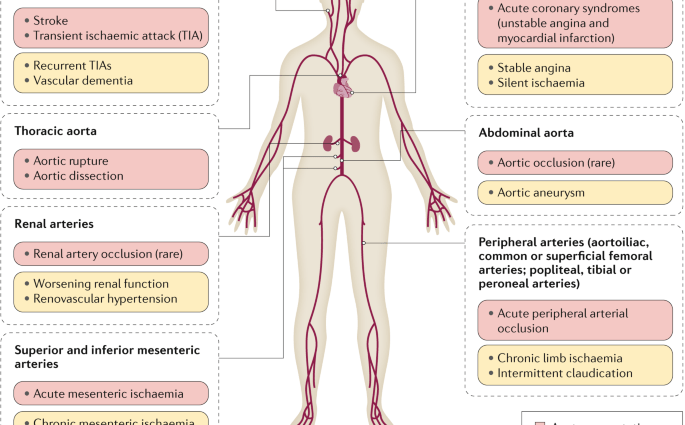 Wavy ears, erection problems. There are more unusual symptoms of atherosclerosis