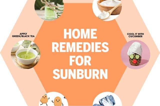 Ways to sunburn. Cool shower, honey, aloe, herbal compresses