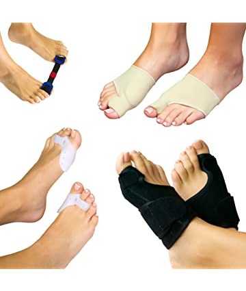 Ways to treat bunions at home &#8211; insoles, splints, socks, massages