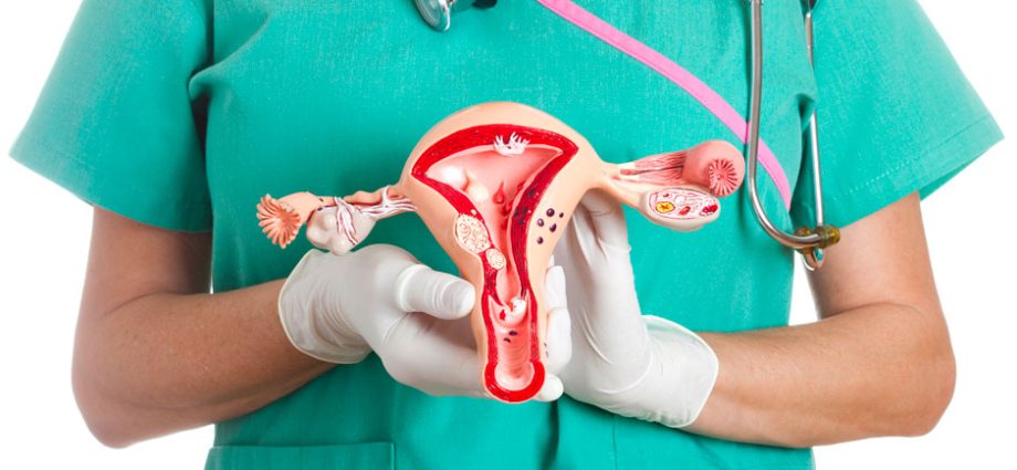 &#8220;We don&#8217;t catch precancerous conditions&#8221; &#8211; ovarian cancer is still a sneaky killer