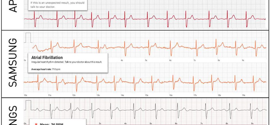 We will do the EKG at the post office