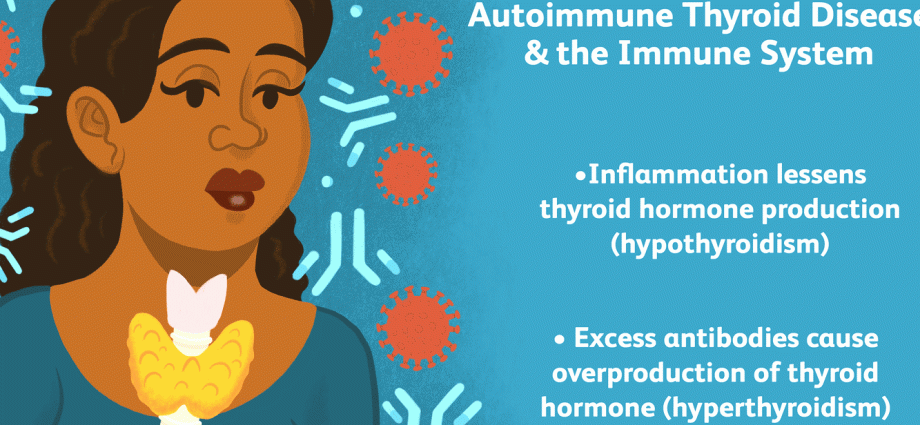 Weakened immunity as a consequence of Hashimoto&#8217;s disease