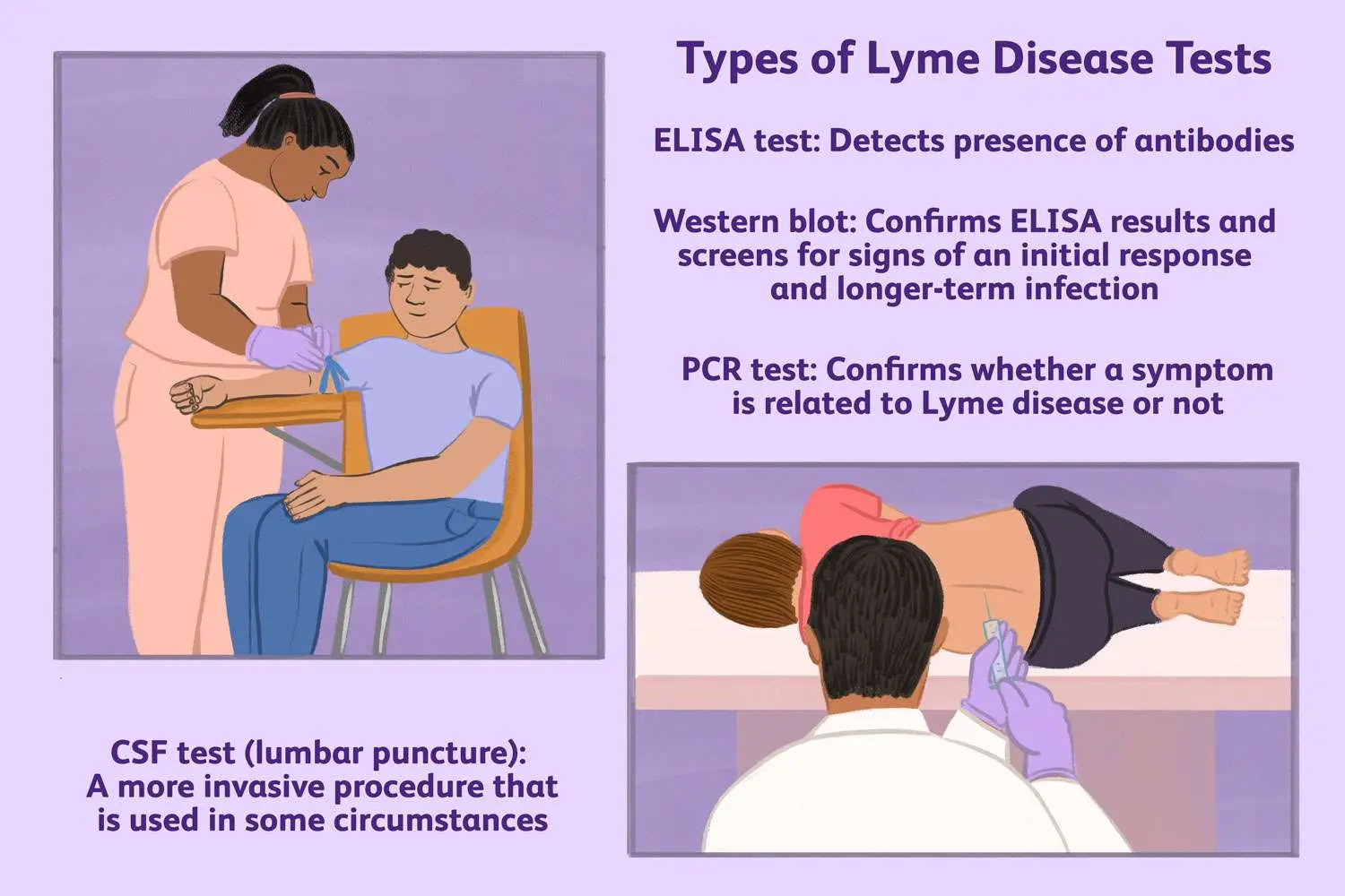 Western Blot test &#8211; indications, interpretation of results and price. Diagnosis of Lyme disease, HIV and herpes