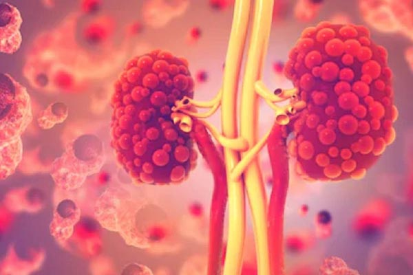 What are kidney diseases and how do they manifest themselves?