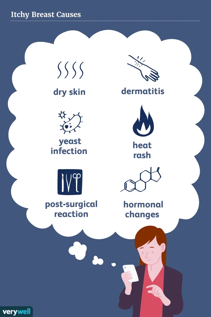 What are the causes of itchy nipples?