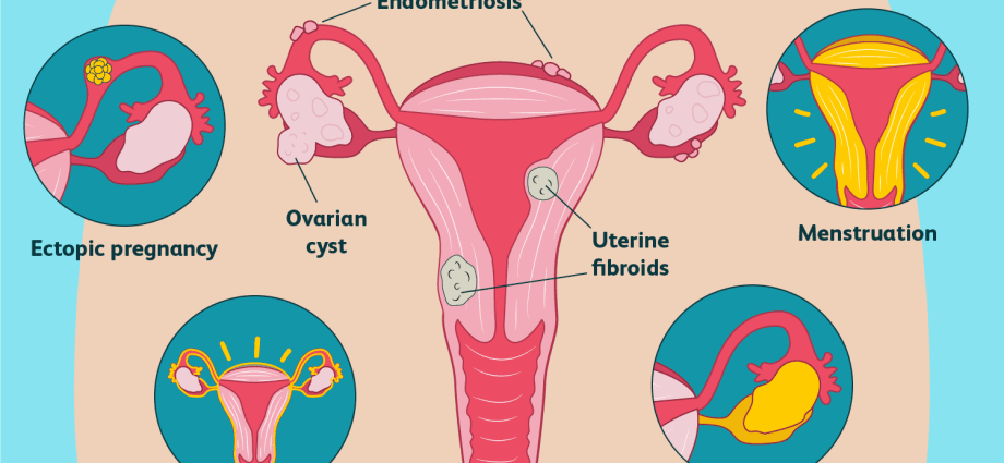 what-are-the-causes-of-pain-in-the-right-ovary-healthy-food-near-me