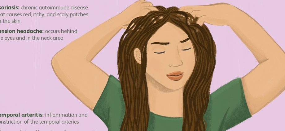 What are the causes of scalp pain?