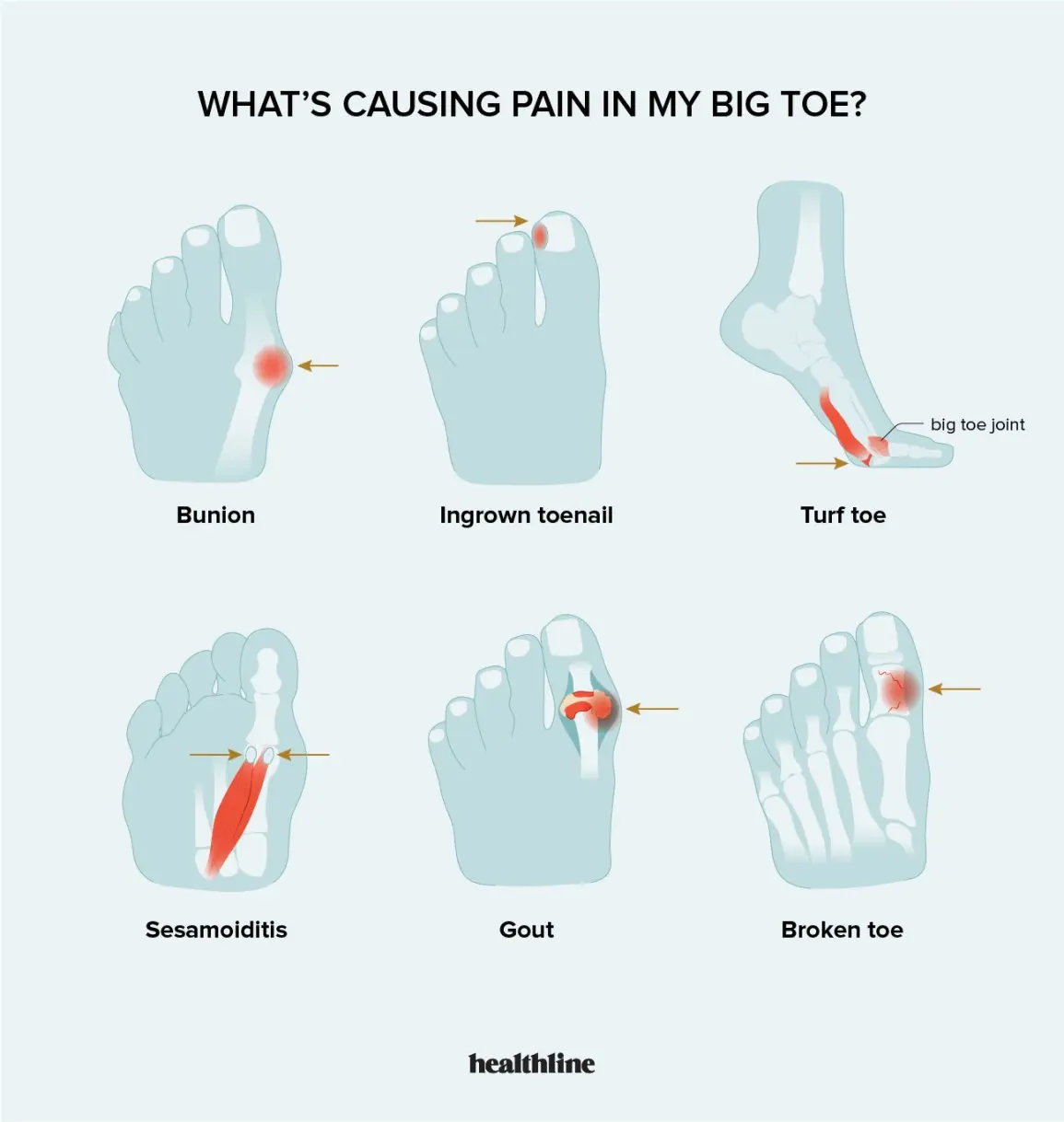 What are the causes of toe pain?