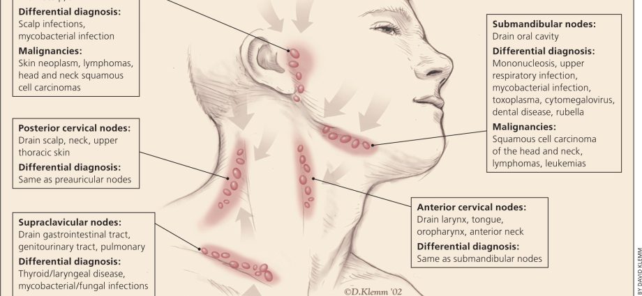 What are the proof of enlarged submandibular lymph nodes?