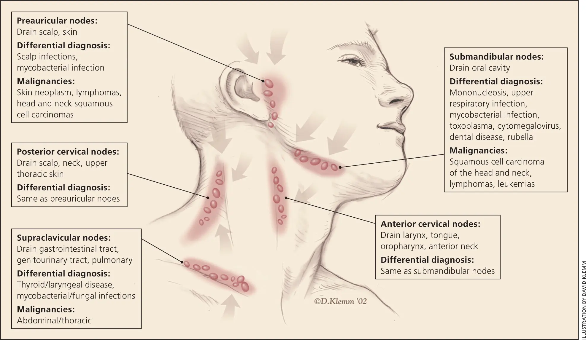 What are the proof of enlarged submandibular lymph nodes?