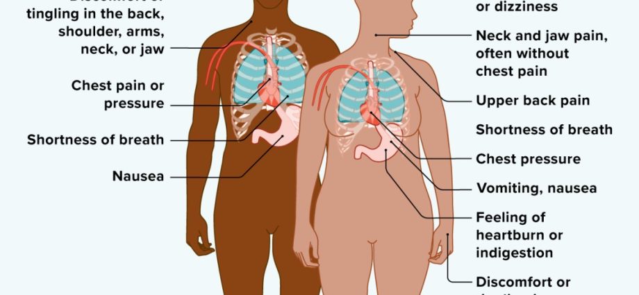 What are the symptoms of a heart attack? [WE EXPLAIN]