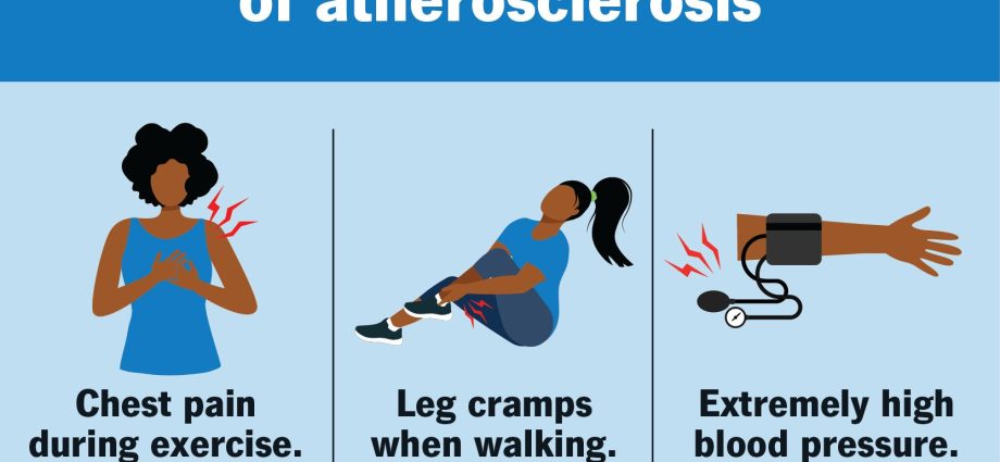 What are the symptoms of aortic atherosclerosis?