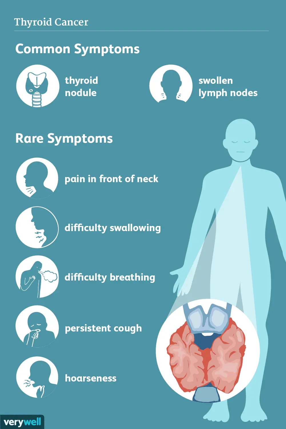 What are the symptoms of thyroid cancer?