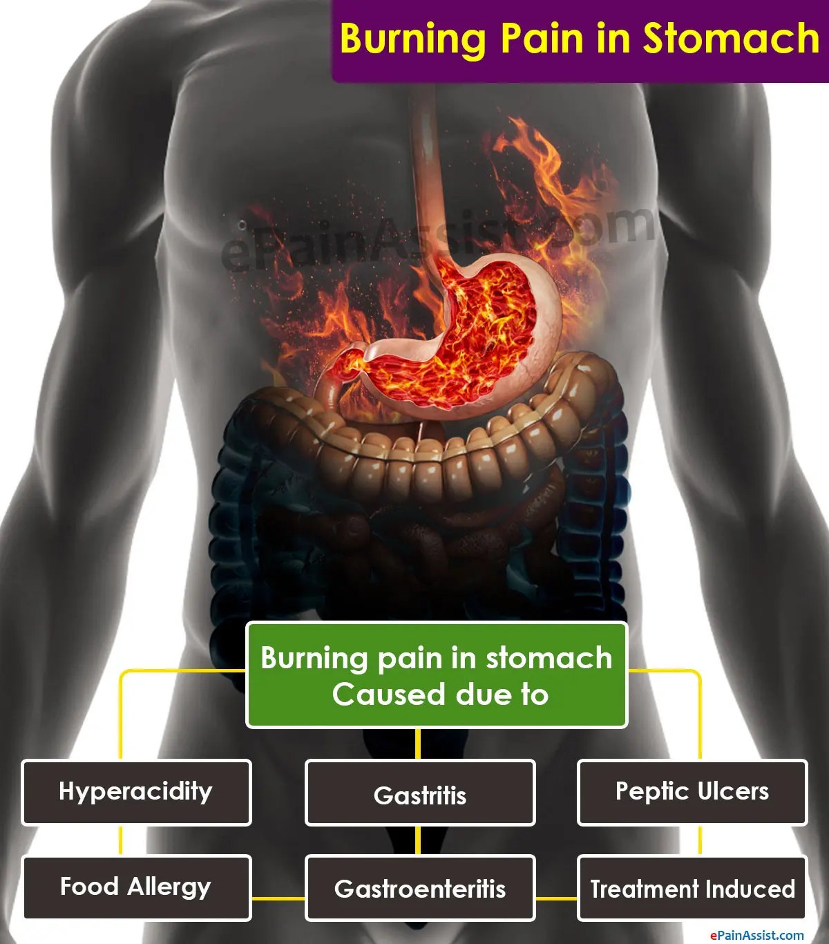 What can be caused by stinging in the abdomen?