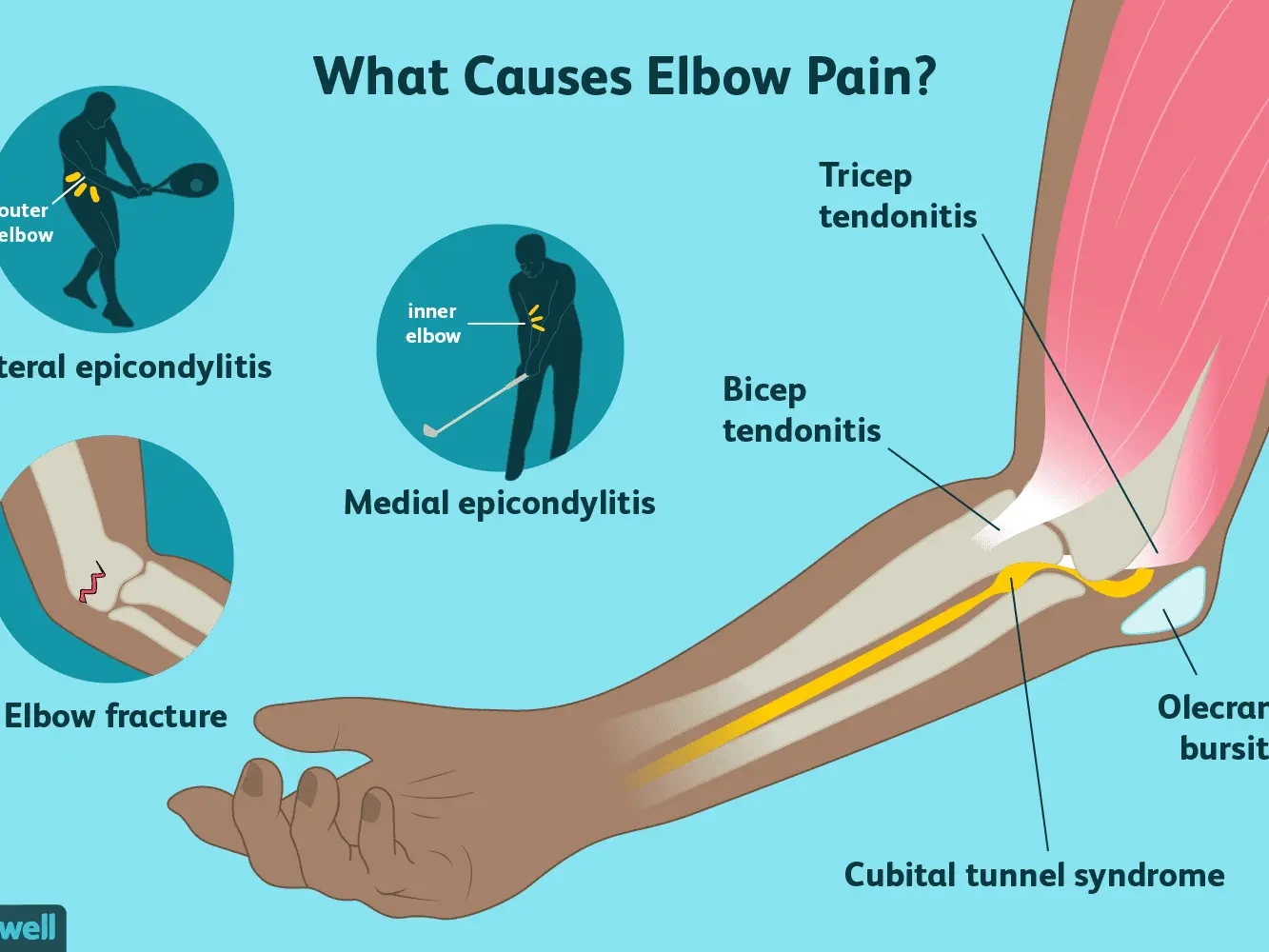 What can elbow pain mean?