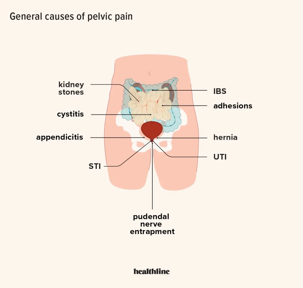 What causes a man&#8217;s lower abdominal pain?