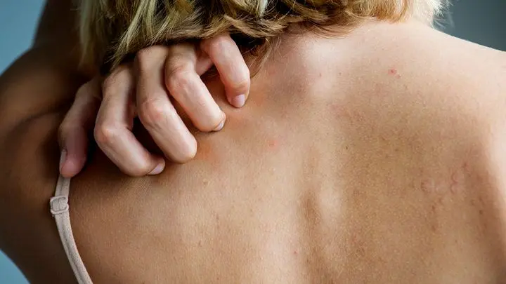 What causes a rash on the back?