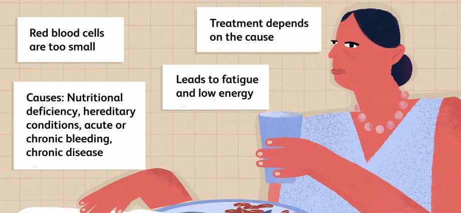 What causes microcytic anemia and how to treat it?