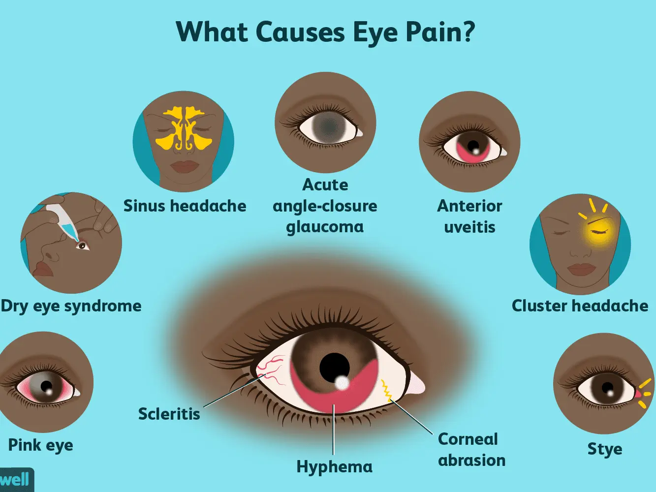 What causes orbital pain?