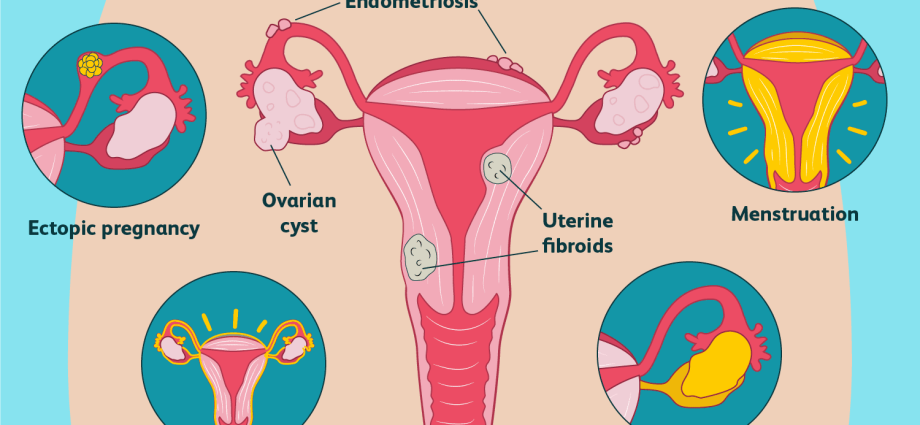 What causes ovarian pain after intercourse?