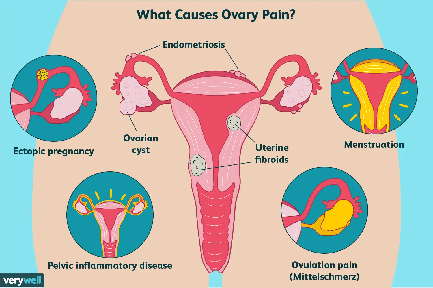 What causes ovarian pain after intercourse?