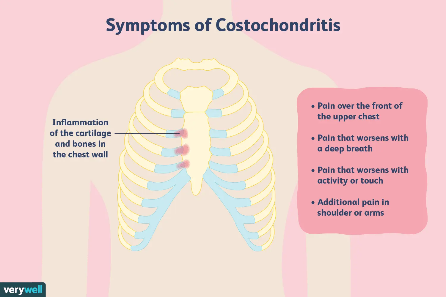 What causes pain under the breastbone? Learn the 5 diseases that cause pain