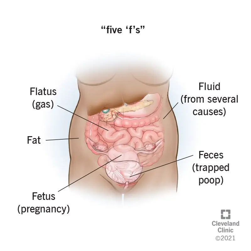 What could be the cause of a hard, bloated stomach?