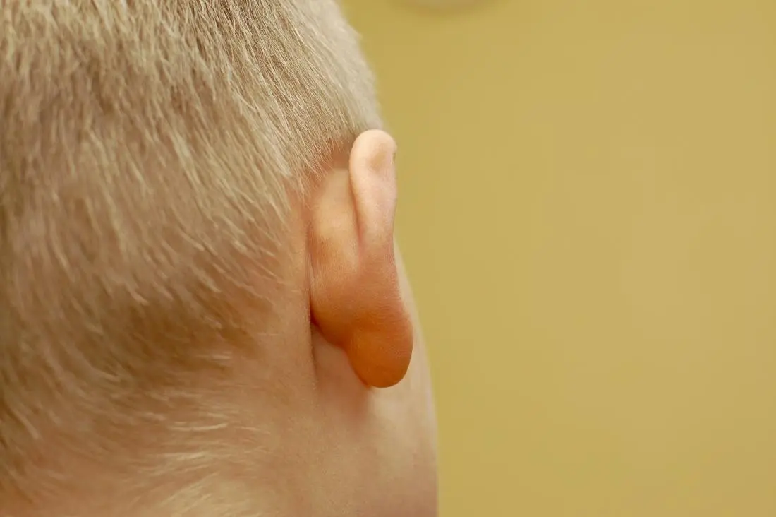 What could the lump behind the ear mean?