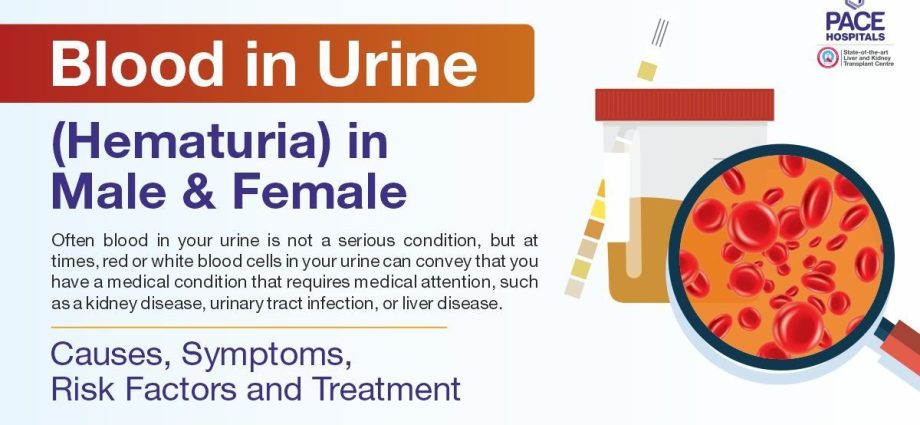 What do blood clots in the urine show?