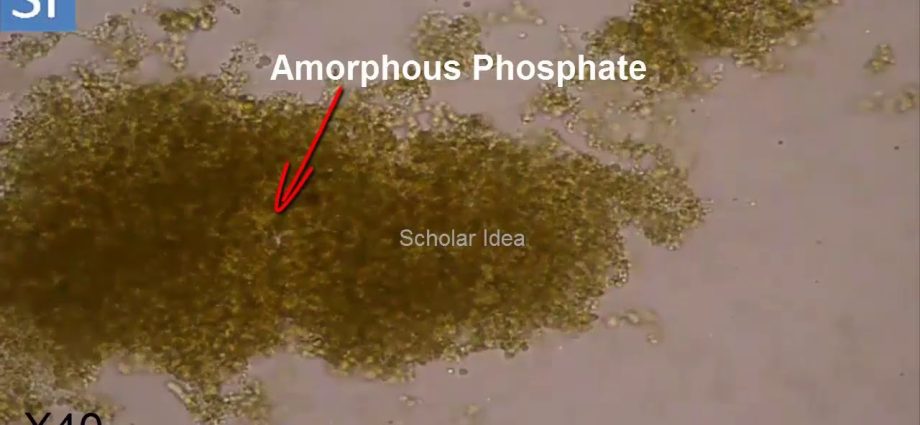 What do phosphates in urine mean?