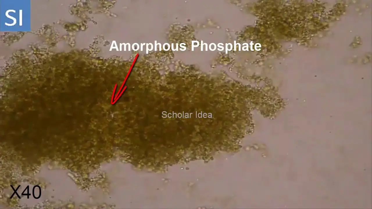 What do phosphates in urine mean?